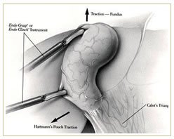 Slider image (5) Panama Gastric Surgery Center
